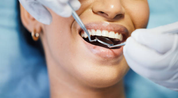 Best Chipped Tooth Repair Near Me  in Sulphur Springs, AR